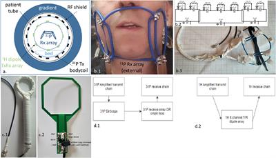 RF Coil Setup for 31P MRSI in Tongue Cancer in vivo at 7 T